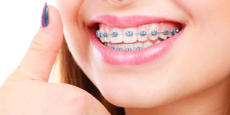 braces treatment in nashik