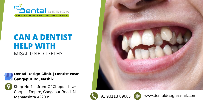 Can a dentist help with misaligned teeth?