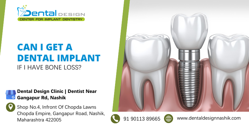 Can I get a dental implant if I have bone loss?