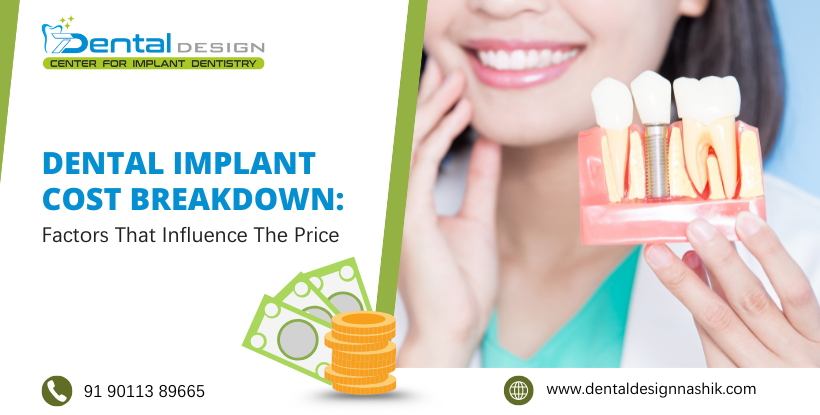 Dental Implant Cost Breakdown