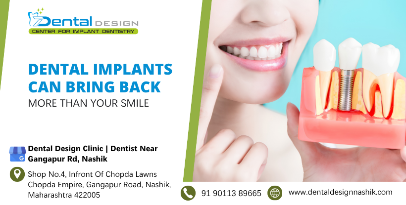 Dental Implants Can Bring Back More Than Your Smile