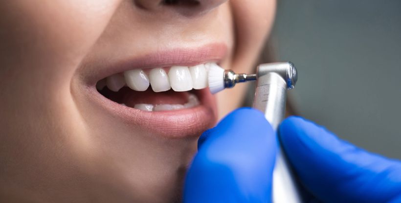 teeth cleaning cost in gangapur road Nashik