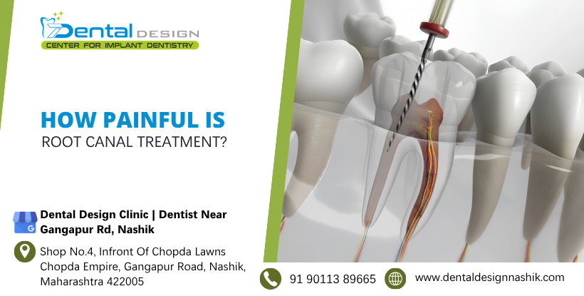 How painful is root canal treatment?