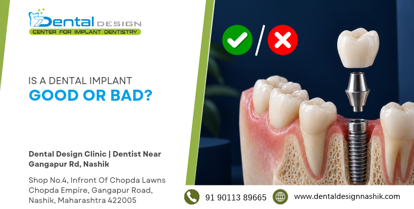 Is A Dental Implant Good Or Bad ?
