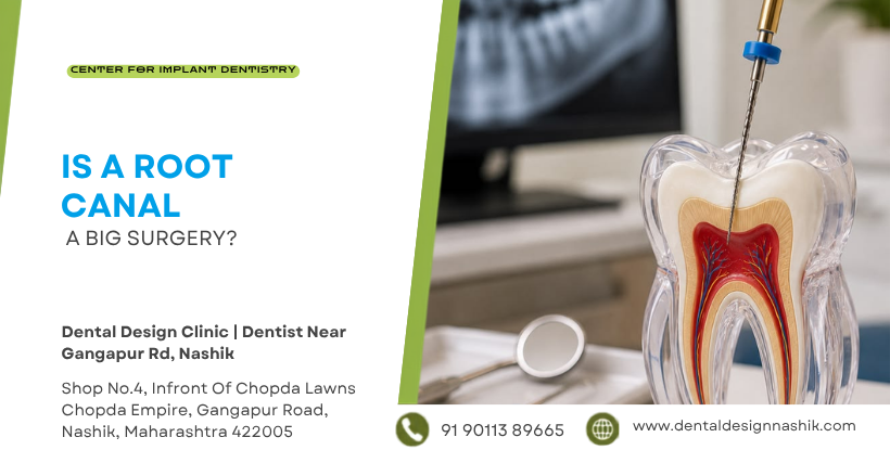Is A Root Canal A Big surgery ?