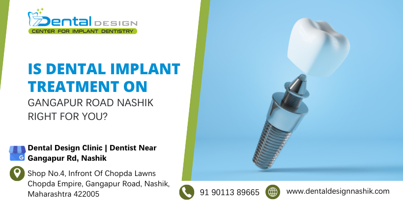 dental implant treatment in gangapur road nashik