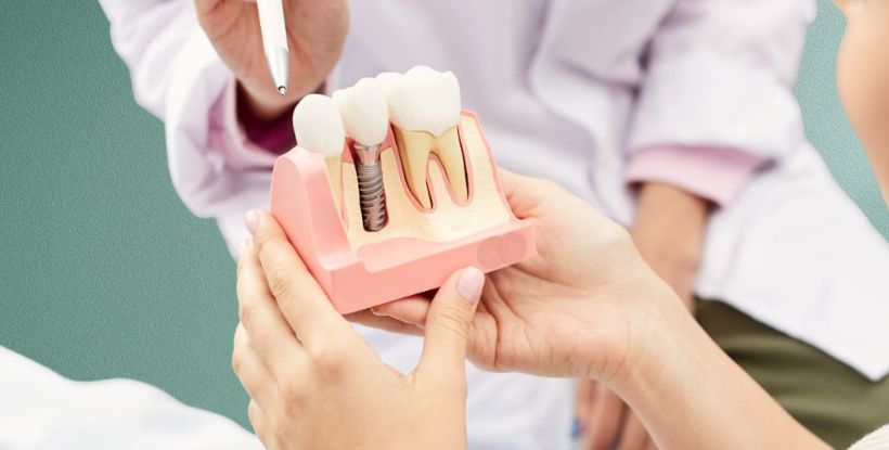 single tooth implant treatment Nashik