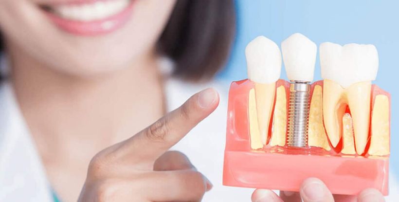 dental implant treatment in gangapur road Nashik