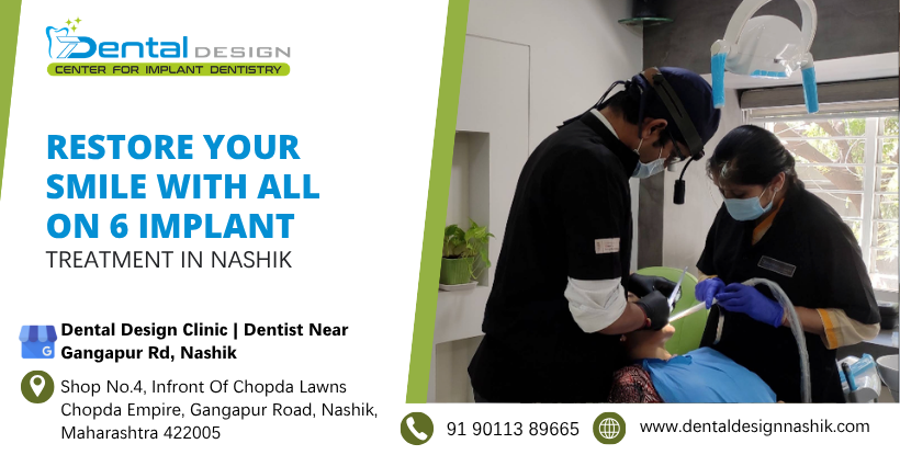 All on 6 Implant Treatment in Nashik