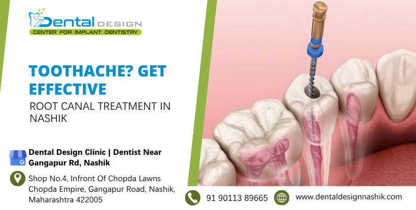 root canal treatment in nashik