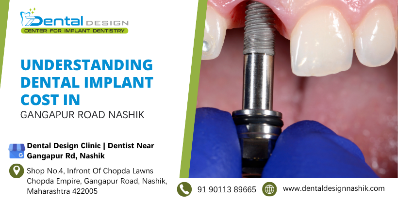 Understanding Dental Implant Cost in Gangapur Road Nashik