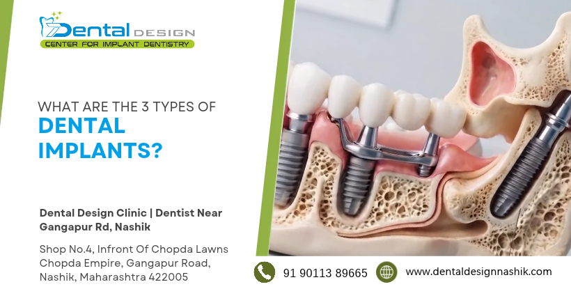 What Are The 3 Types Of Dental Implants ?