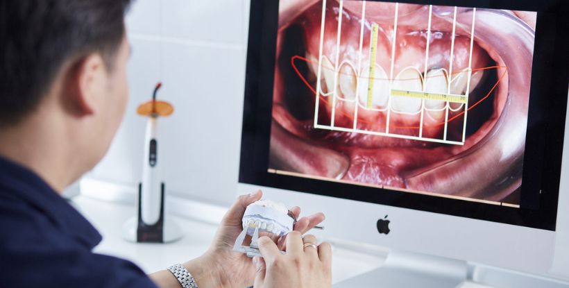 Digital Smile Designing