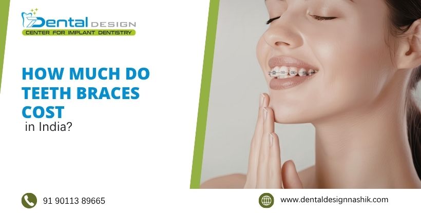 Teeth Braces Cost in India