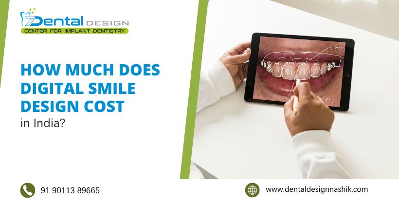 digital smile design cost in nashik