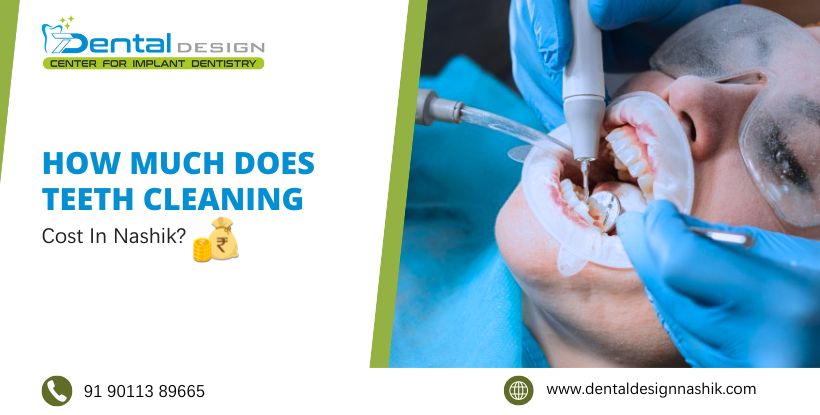 How Much Does Teeth Cleaning Cost in Nashik?