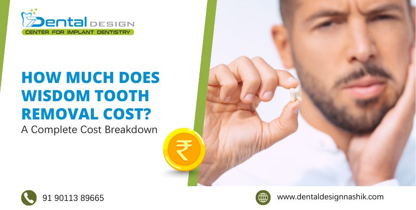 wisdom tooth removal cost in Nashik