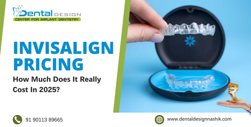 aligners treatment cost in Nashik
