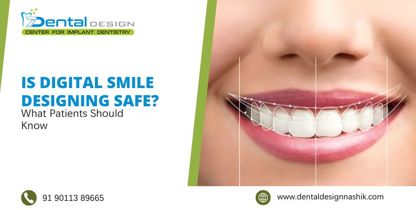 digital smile designing in Gangapur Road Nashik