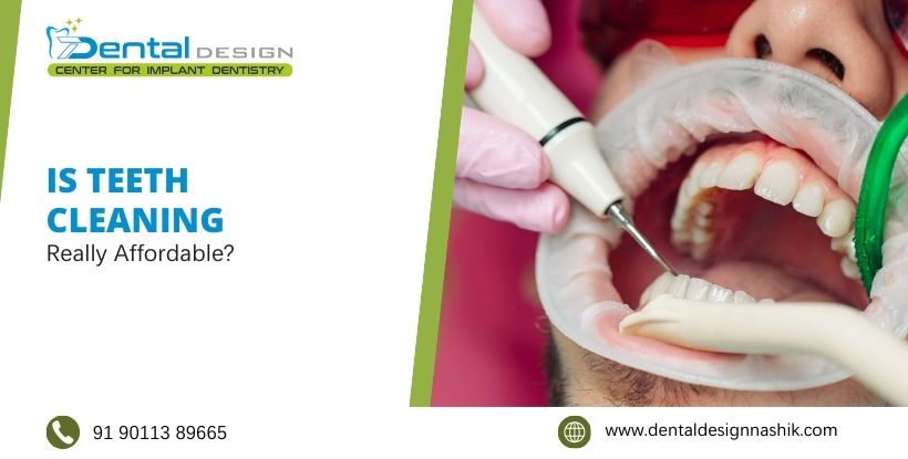 teeth cleaning cost in Nashik