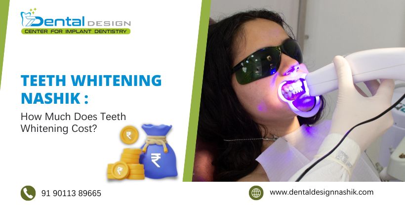 Teeth Whitening Nashik