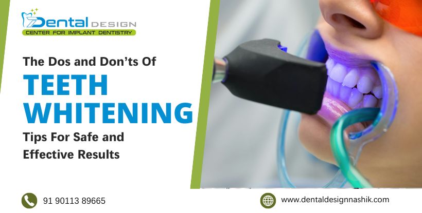 teeth whitening in Nashik