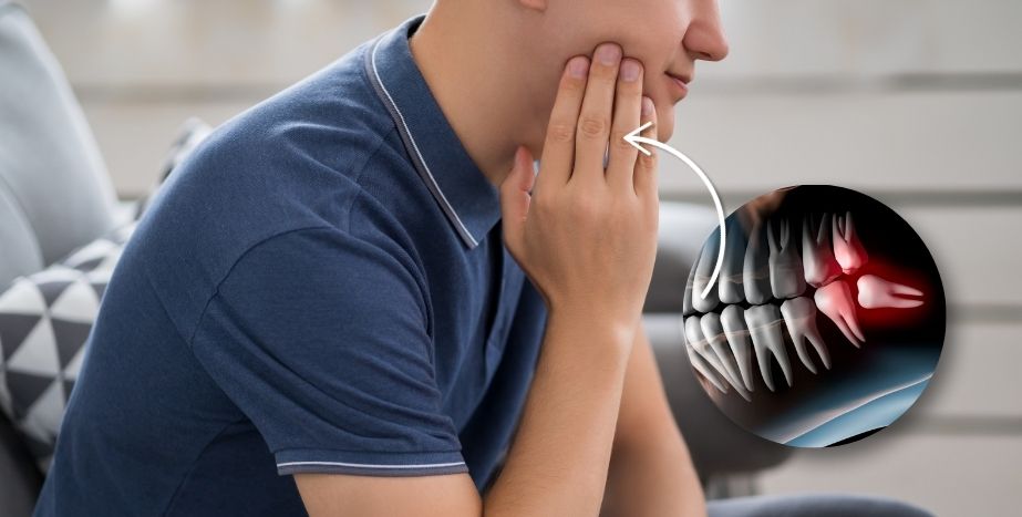 Costs of Wisdom Tooth Removal