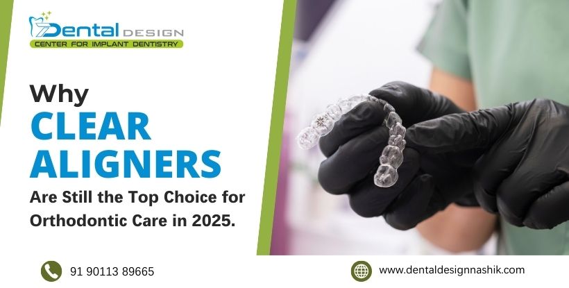 Clear Aligners